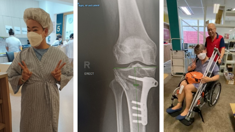 Kindness is not a crutch: Knee surgery forced me to depend on others and I was surprised by their compassion!