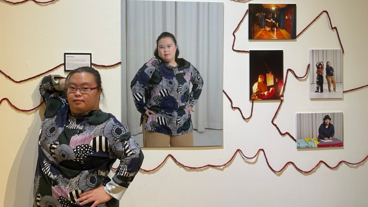 Down but not out: Exhibition at *SCAPE showcases talents of dancers with special needs