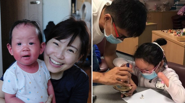 Kids with rare skin conditions: 