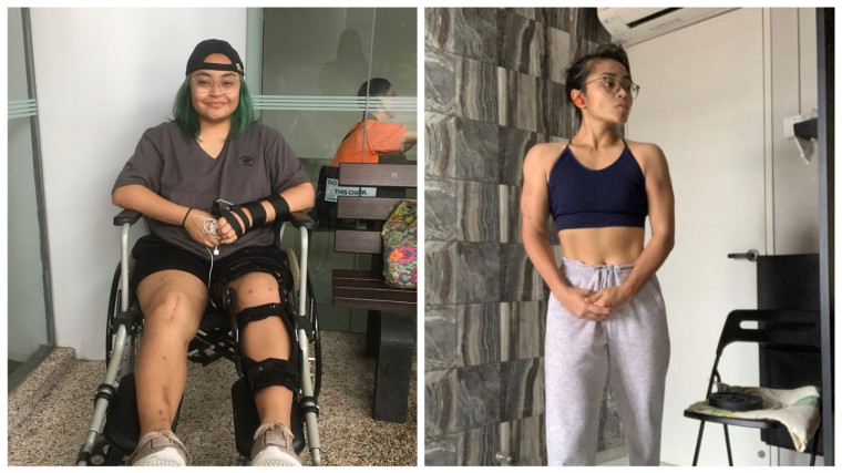 Surviving the impossible: “I fell off a 16-storey building and lived”